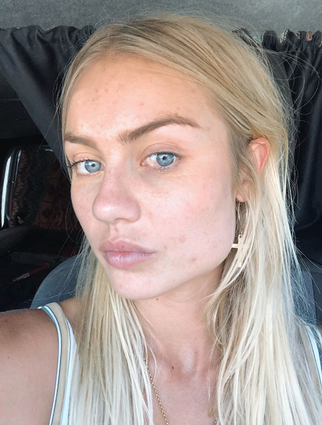 Elyse Knowles Cosmetic Surgery Face