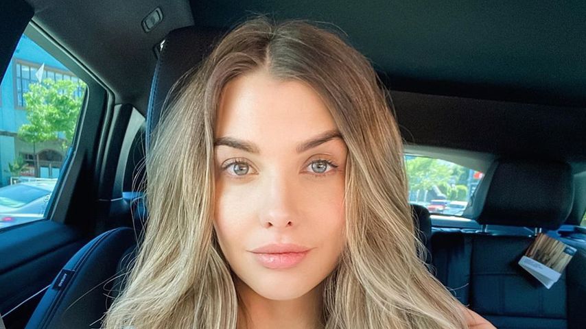 Emily Sears Plastic Surgery Face