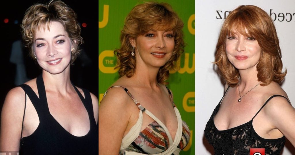 Sharon Lawrence Cosmetic Surgery Body