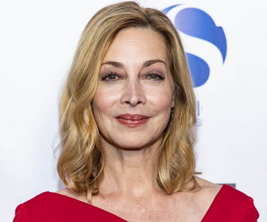 Sharon Lawrence Plastic Surgery Face
