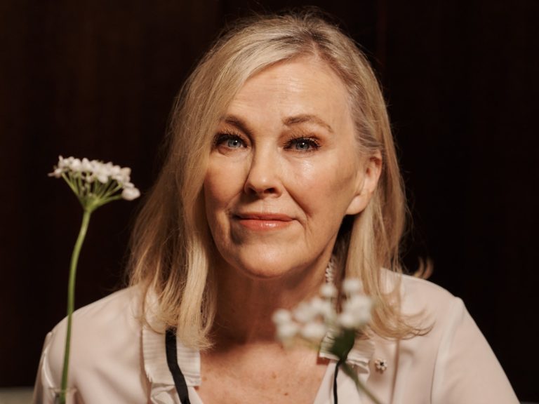 Catherine O'Hara Plastic Surgery Procedures