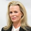 Kim Basinger Plastic Surgery Procedures