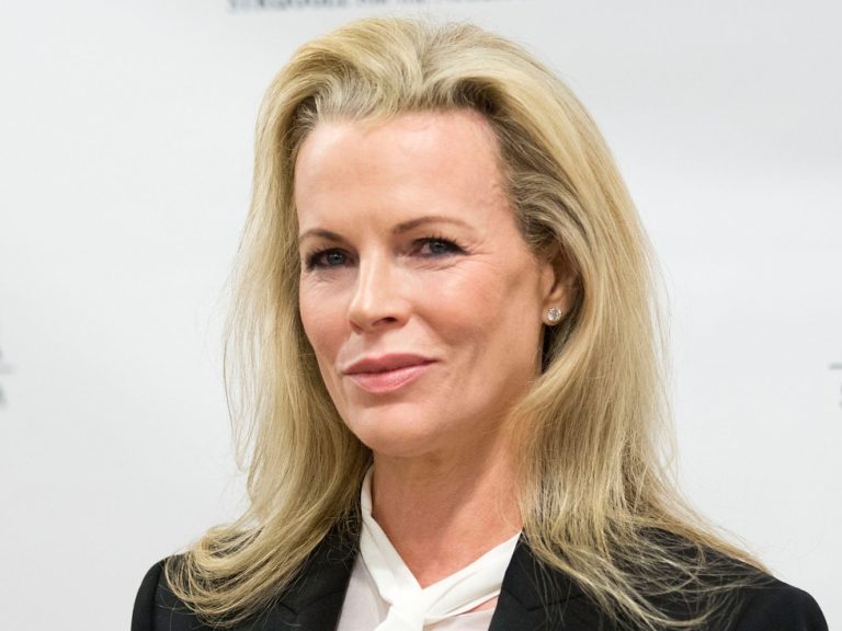 Kim Basinger Plastic Surgery Procedures