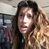 Tania Raymonde Plastic Surgery Procedures