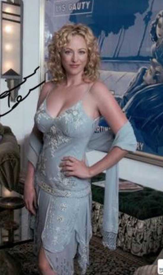 Virginia Madsen Cosmetic Surgery Body