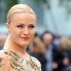 Malin Akerman Plastic Surgery Procedures