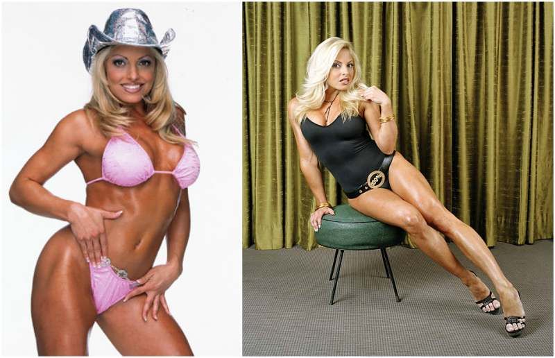 Trish Stratus Plastic Surgery Body