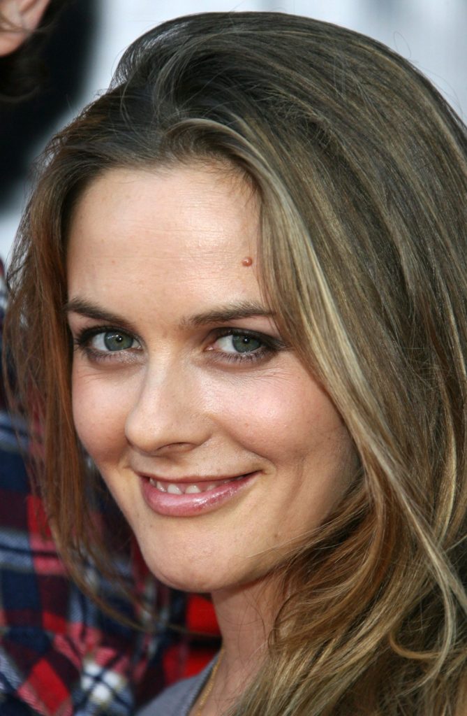 Alicia Silverstone Cosmetic Surgery Face