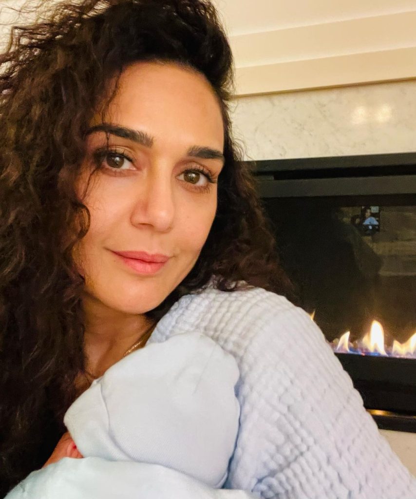 Preity Zinta Cosmetic Surgery Face