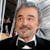 Burt Reynolds Plastic Surgery Procedures