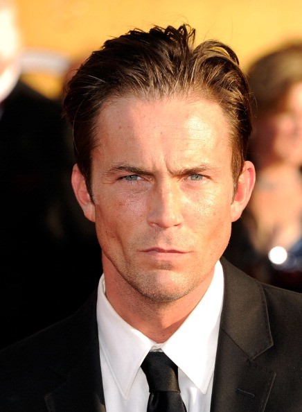 Desmond Harrington Cosmetic Surgery