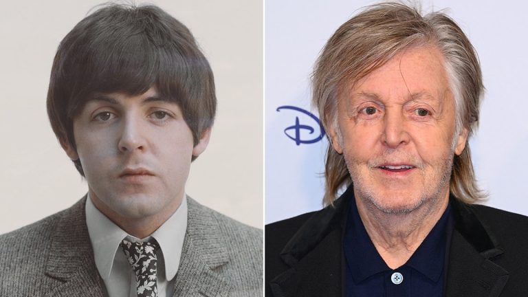 Paul McCartney Plastic Surgery