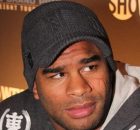 Alistair Overeem Cosmetic Surgery
