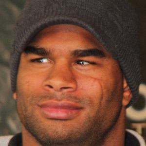 Alistair Overeem Plastic Surgery Face