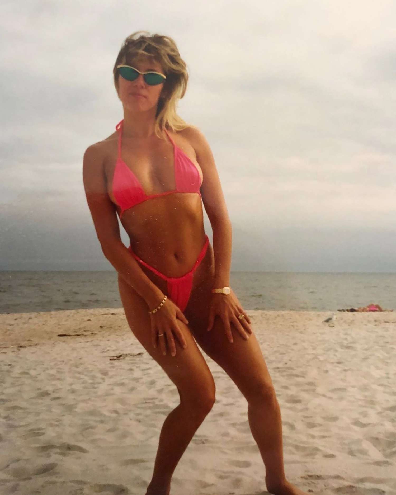 Ramona Singer Plastic Surgery Speculation