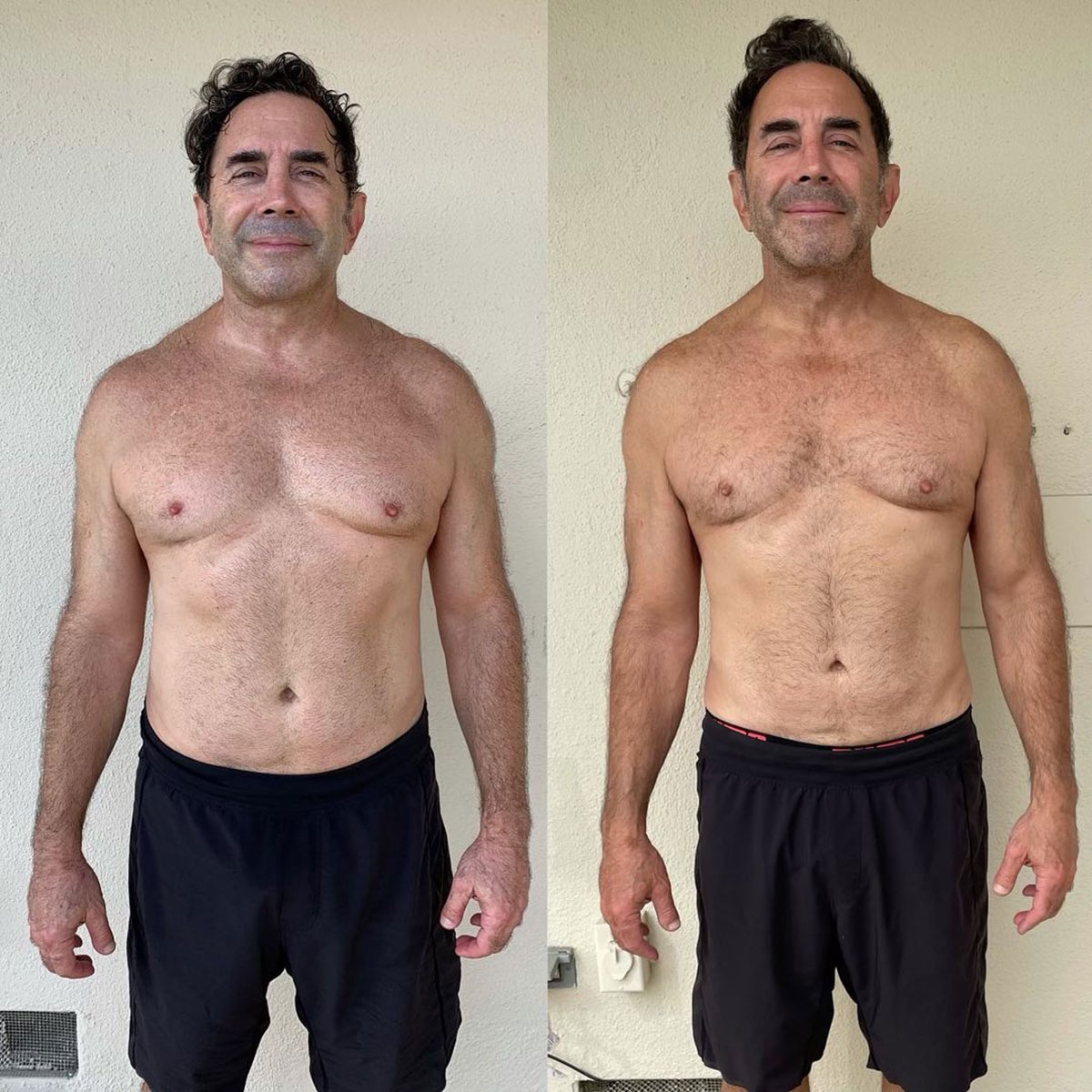 Terry Dubrow and Signs of Plastic Surgery